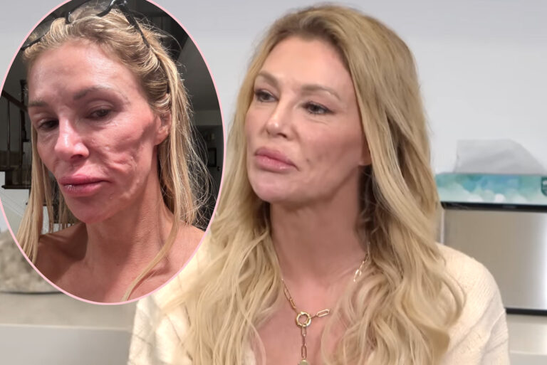 Brandi Glanville Opens Up About Struggling With ‘Deep Depression’ Amid