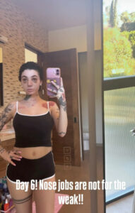 Bhad Bhabie Reveals She Got Nose Job And Clarifies Cancer Diagnosis