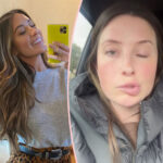 'Worried' Bristol Palin Shares Look At Terrifying Facial Paralysis