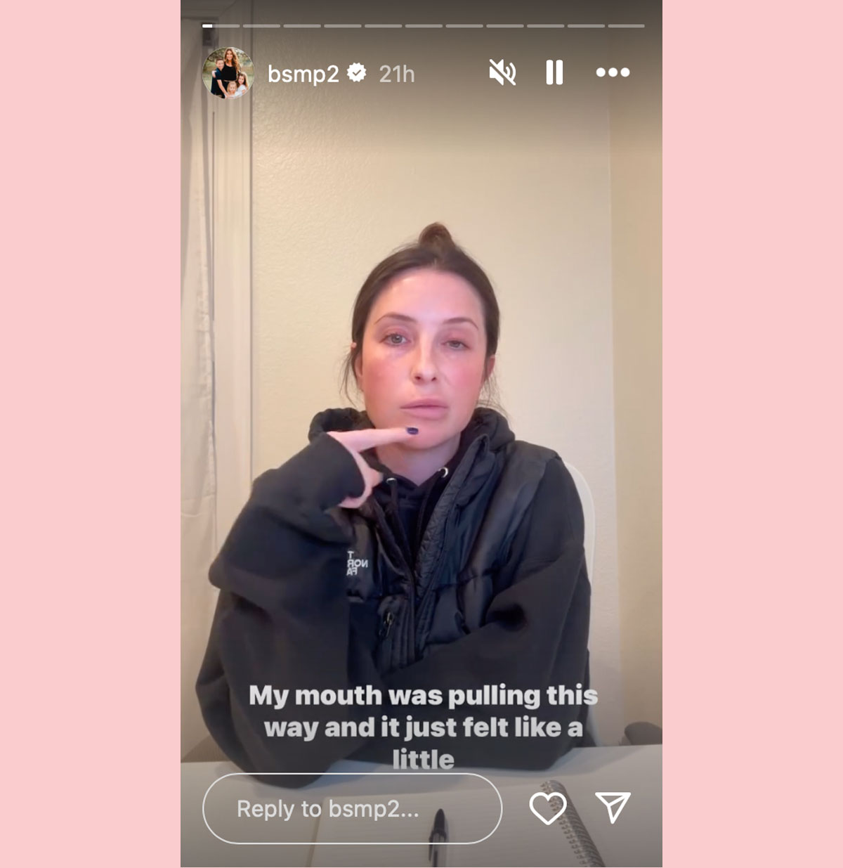 bristol Palin facial paralysis