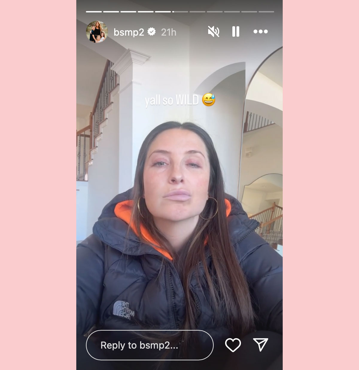 bristol Palin facial paralysis