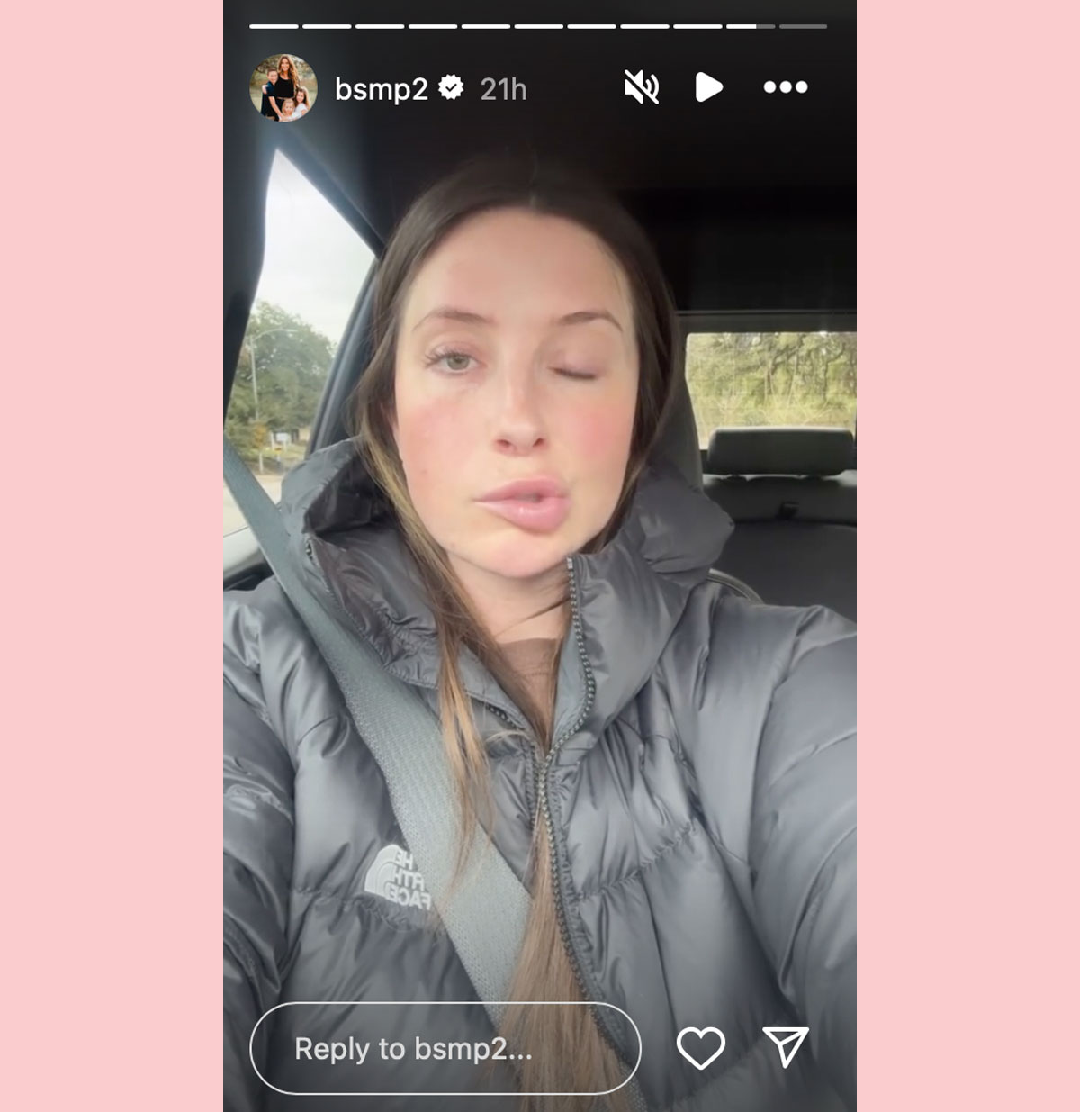 bristol Palin facial paralysis