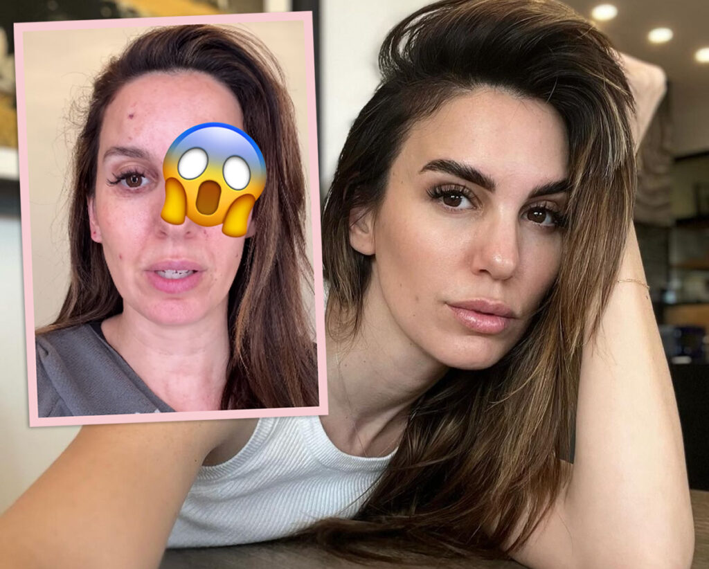 Christy Carlson Romano Reveals She Got Shot IN THE EYE!