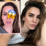 OMG! Christy Carlson Romano Shows Off Horrible Eye Injury After She Got Shot In The Face!