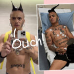 Influencer Rushed To Hospital In Duct Tape Stunt Gone HORRIBLY Wrong -- And It's All On Video!