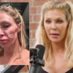 Brandi Glanville Posts Video of Herself Violently Shaking Amid Treatment For Insane Facial Parasite