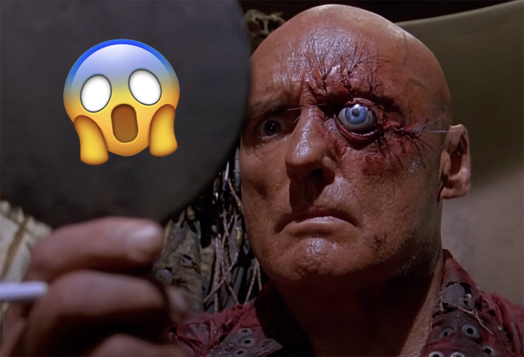 Woman Has Cosmetic Procedure To Resolve 'Facial Asymmetry' Only For WHAT To Pop Out Of Her Eye?!