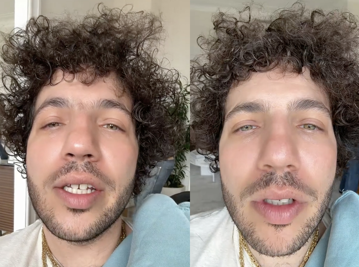 Benny Blanco unibrow Before and After