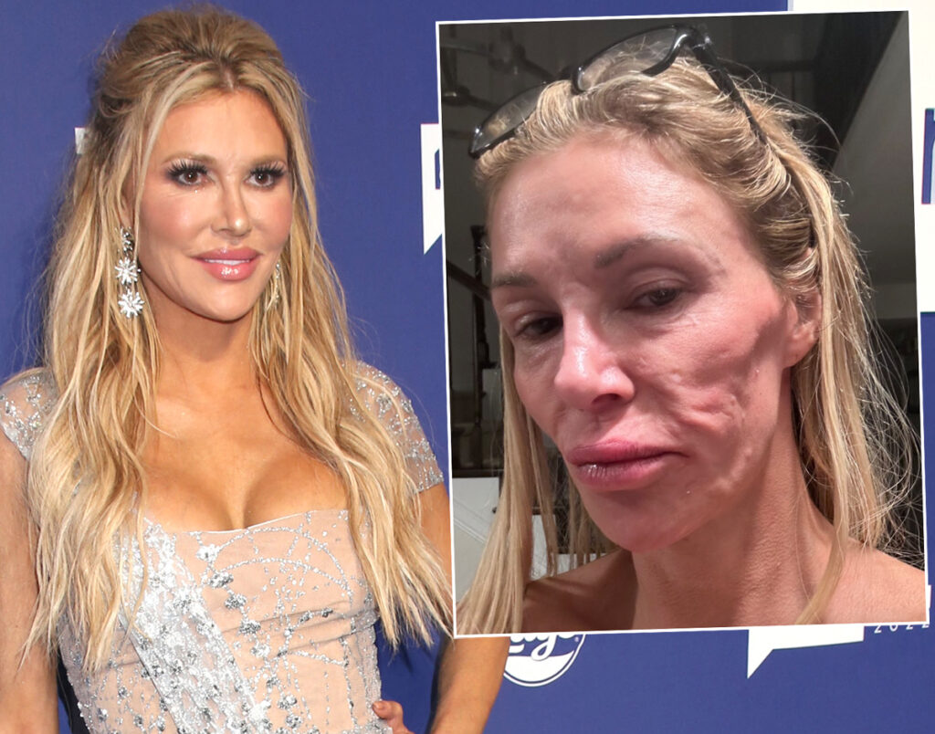 Brandi Glanville Gives Terrifying Health Update About Nasty Discharge 'Eating Away At My Teeth'