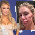 Brandi Glanville Gives Terrifying Health Update About Nasty Discharge 'Eating Away At My Teeth'