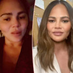 Chrissy Teigen SLAMS Continued Cheek Filler Speculation In Sleep Gummy-Fueled Rant: 'Stop Being Miserable'