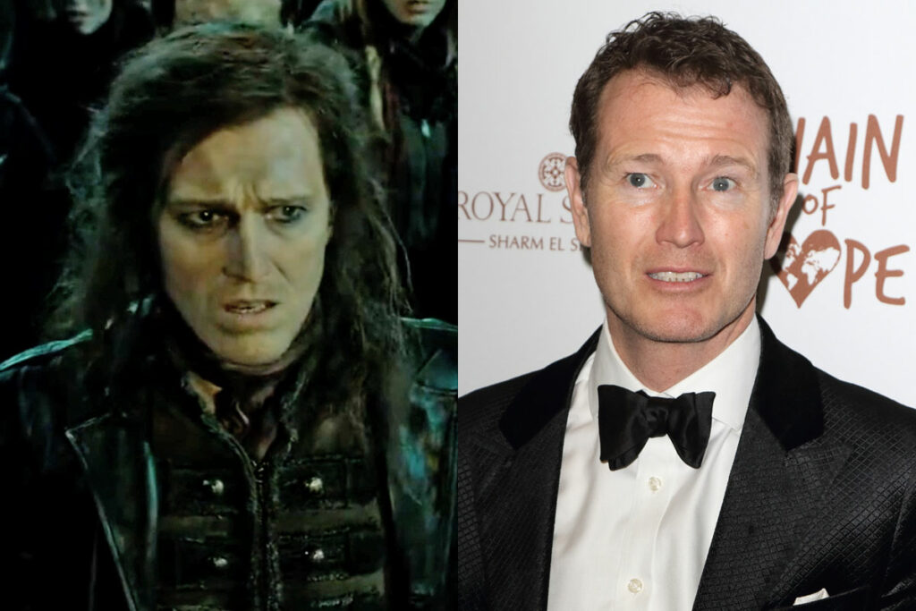 Harry Potter Actor Nick Moran Told He ‘Might Never Walk Or Talk Again’ After Going To The Hospital For Neck Pain!