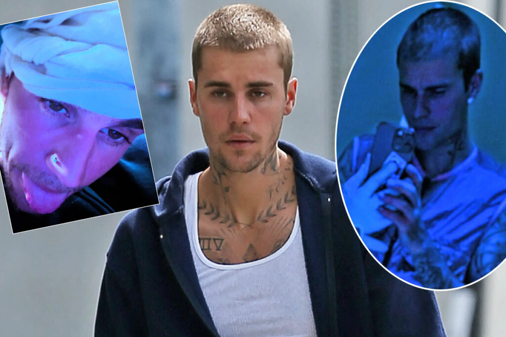 Justin Bieber Fans Renew Concern For His Health After Worrying Coachella Party Footage Emerges