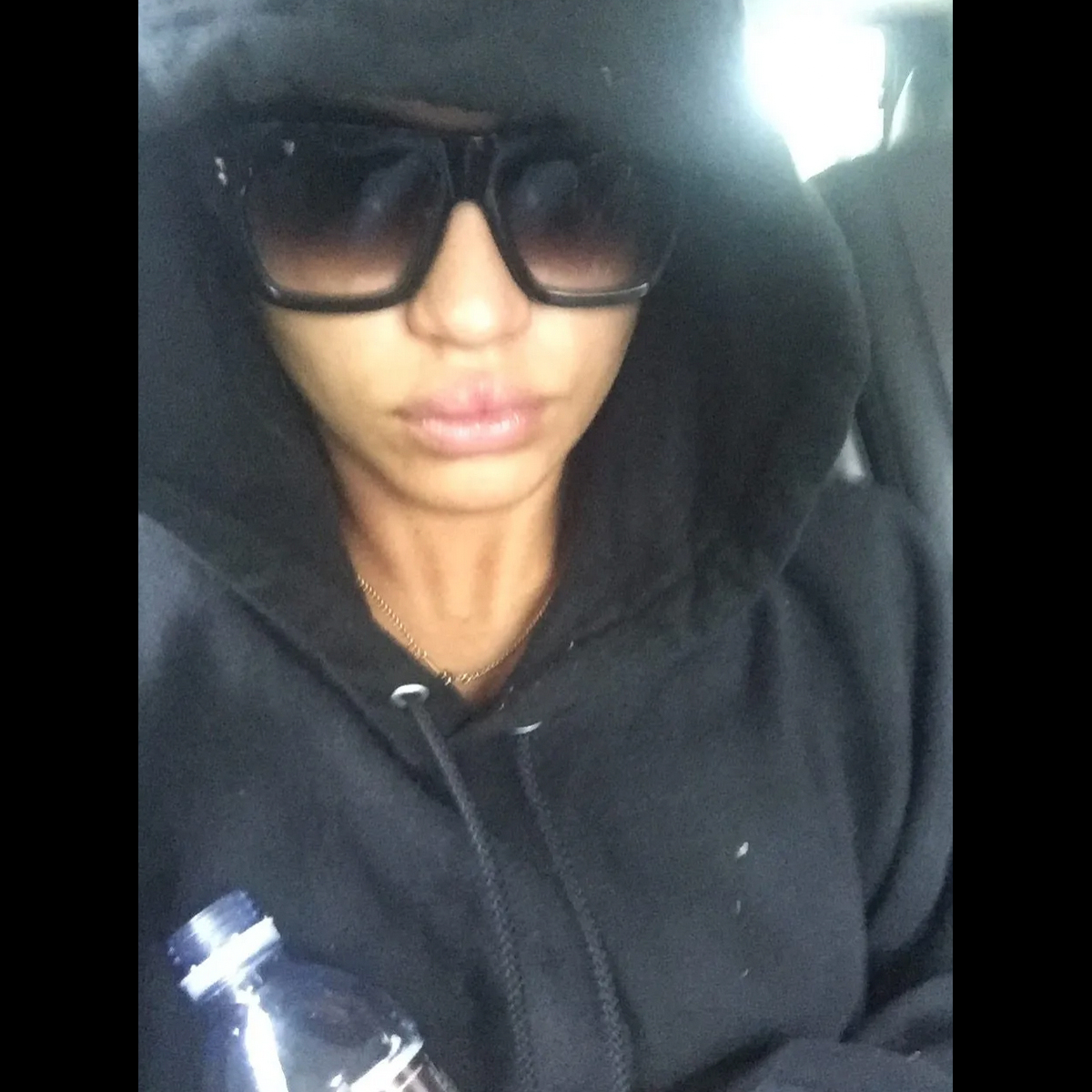 Cassie Injury Photos 2016 hotel aftermath 1