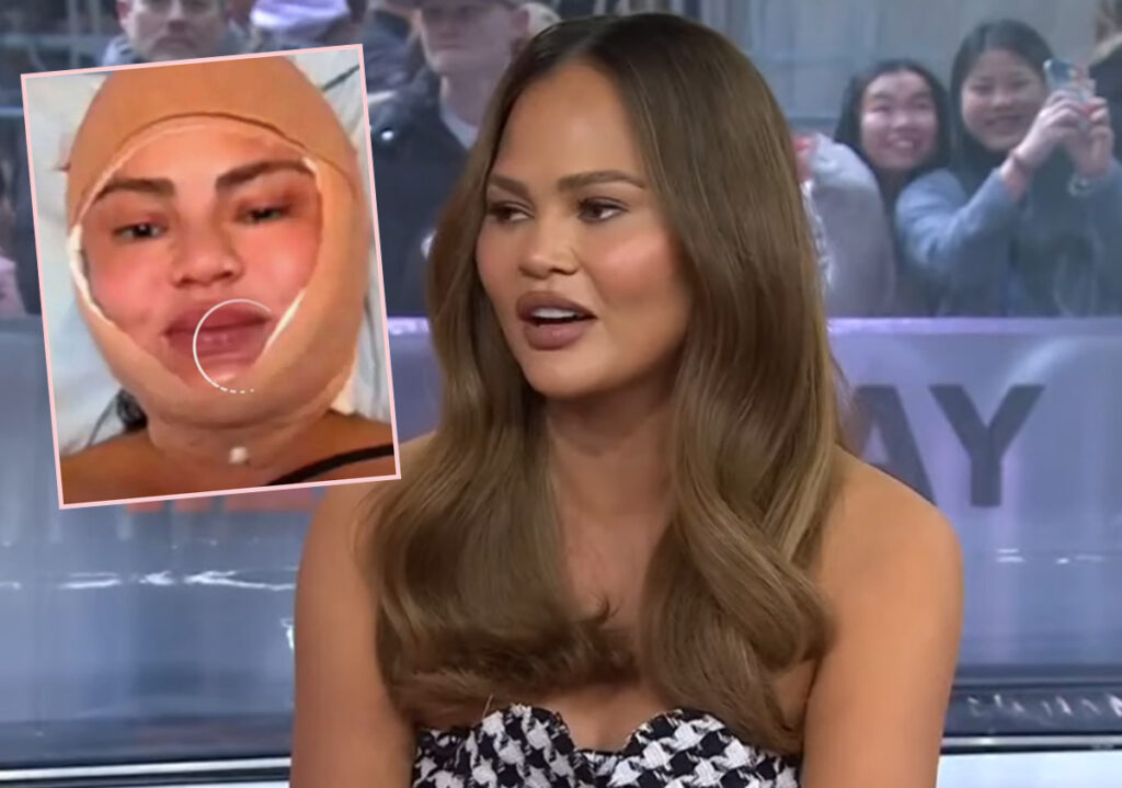 Chrissy Teigen Speaks Out After Concerning IG Live Of Herself With Bandaged Face! 