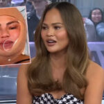 Chrissy Teigen Speaks Out After Concerning IG Live Of Herself With A Bandaged Face! 