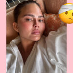 Chrissy Teigen Worries Fans After Shocking IG Live Of Herself In A Hospital Bed With Bandaged Face! 