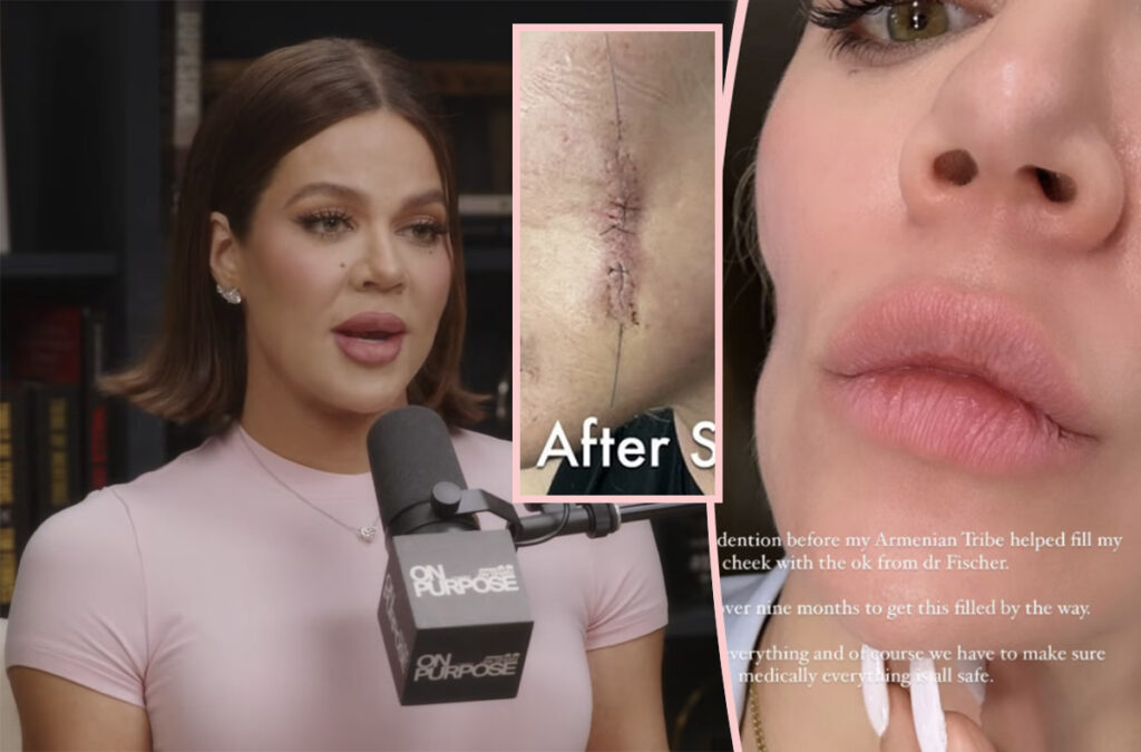 Khloe Kardashian Shares Plastic Surgery Facial Scar Photos