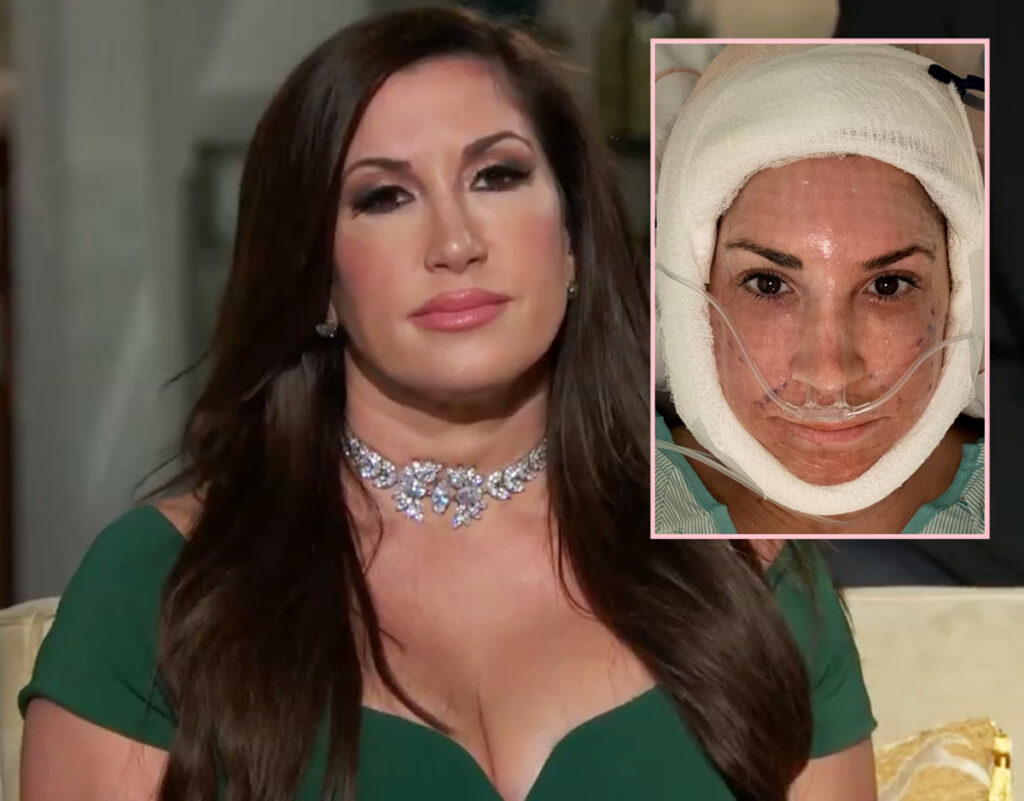 RHONJ Jacqueline Laurita Shares Shocking Video & Pic Of Her Bandaged Face Right After Undergoing Face & Neck Lift