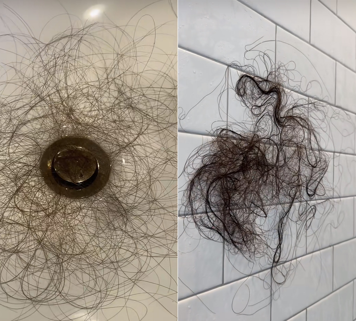 Kyle Richards’ Daughter Sophia Umansky Shows ‘Dramatic Hair Loss’ After Taking Weight Loss Drug