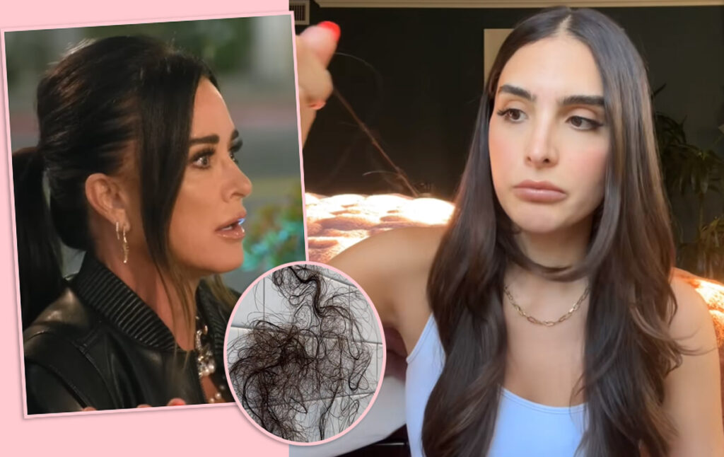 Kyle Richards’ Daughter Sophia Umansky Shows ‘Dramatic Hair Loss’ After Taking Weight Loss Drug