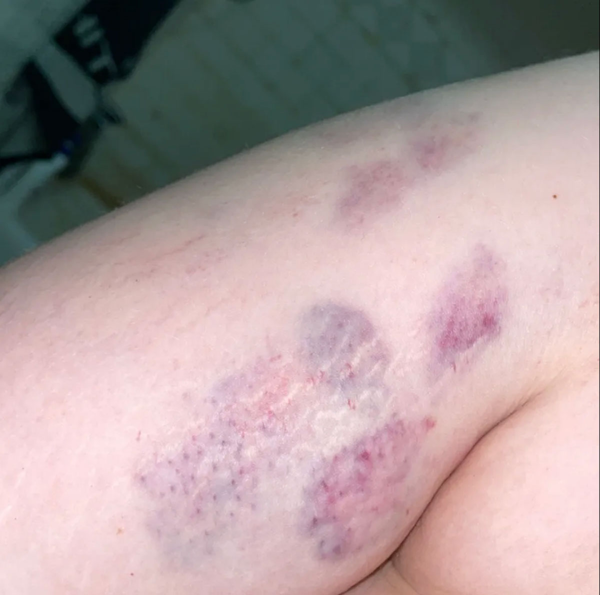 Lesbian Teen Viciously Attacked & Robbed At McDonalds After Trying To Use Women’s Bathroom