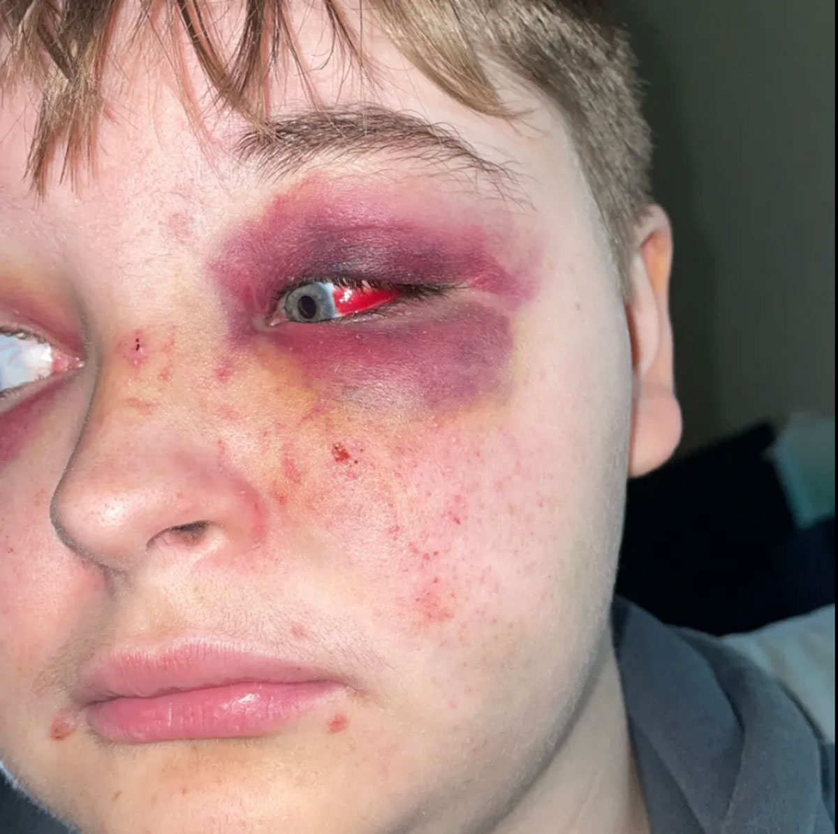 Lesbian Teen Viciously Attacked & Robbed At McDonalds After Trying To Use Women’s Bathroom