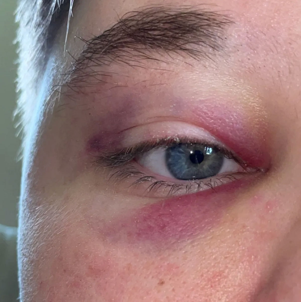 Lesbian Teen Viciously Attacked & Robbed At McDonalds After Trying To Use Women’s Bathroom