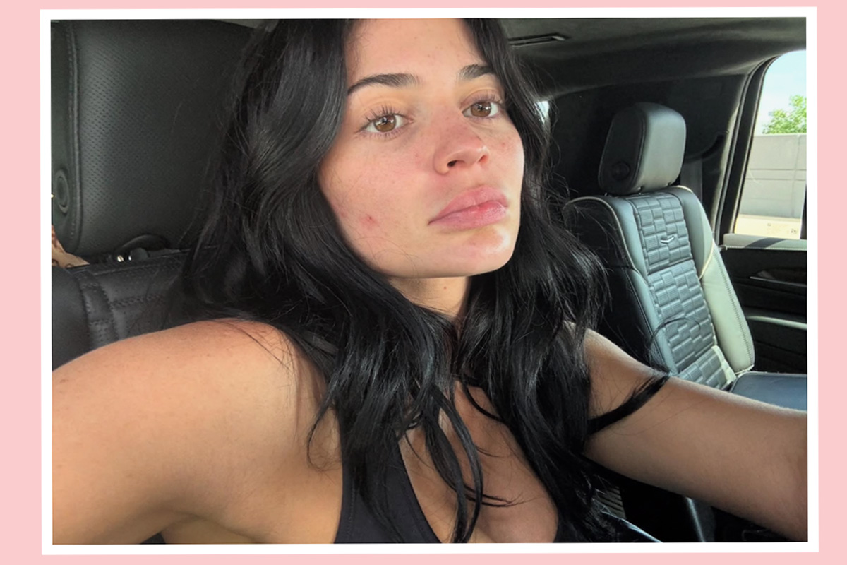 Kylie Jenner Reveals TRULY MAKEUP-FREE Self -- Redness, Pimple, And All!