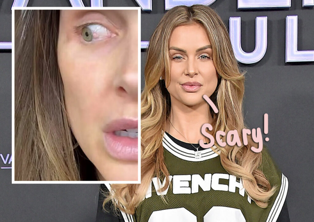 Lala Kent Says She's Taking Chemo Drops For Pre-Cancerous Growth On Her Eye! Oh No!