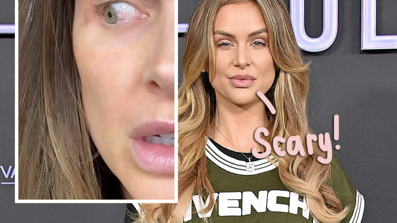 Lala Kent Shares the Latest on Her Pre-Cancer Eye Abnormality & Chemotherapy Treatment