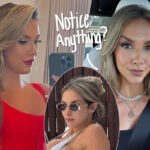 Allison Holker Flaunts HUGE Breast Implants In Pics With New CEO Boyfriend! Look!