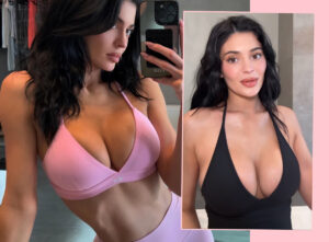 Kylie Jenner Breast Implants Are TOO BIG, Says Plastic Surgeon! Here's