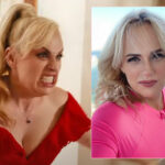 Rebel Wilson Had To Get Plastic Surgery After 'Freak Accident' On Movie Set Nearly Left Her 'Disfigured'