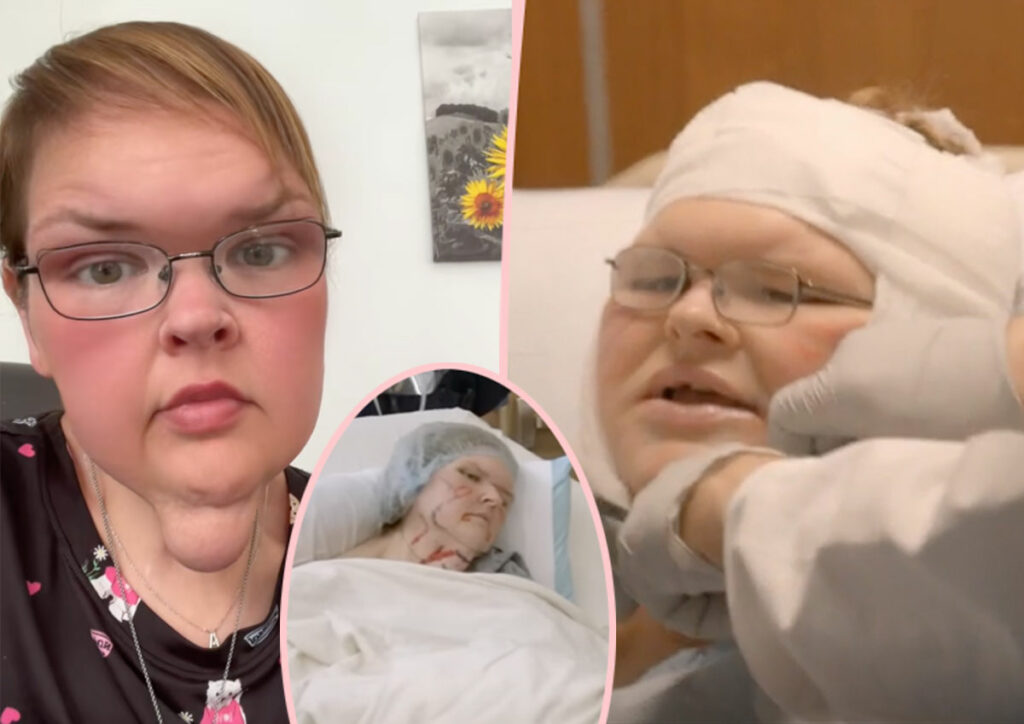 1,000-Lb Sisters' Tammy Slaton Reveals Skin Surgery Transformation Shock: 'I Feel So Weird'