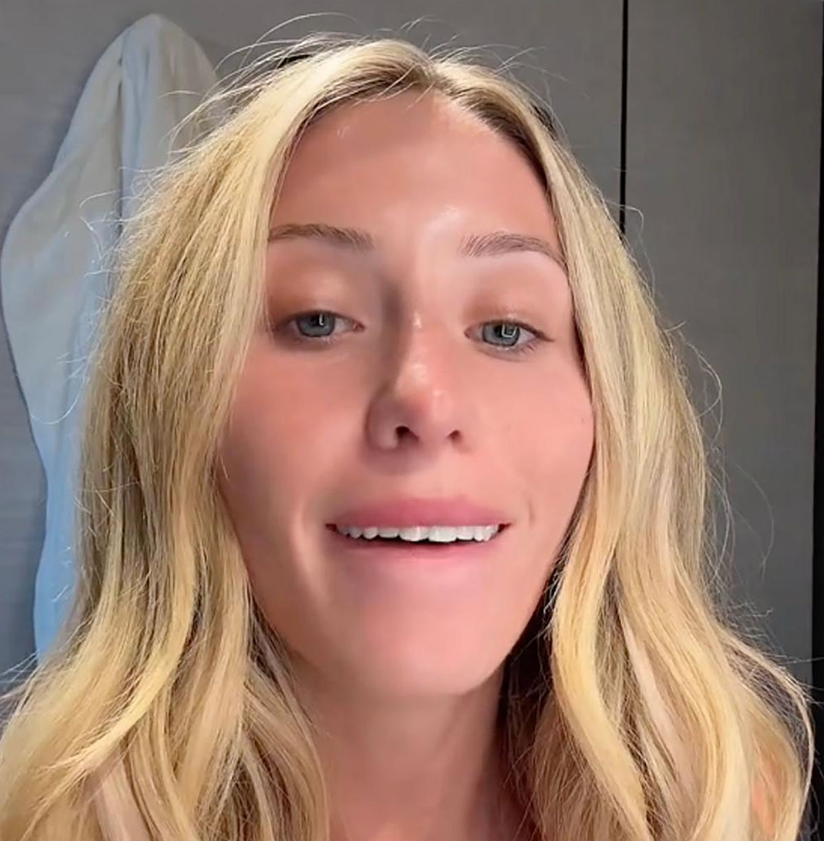 Alix Earle chipped tooth