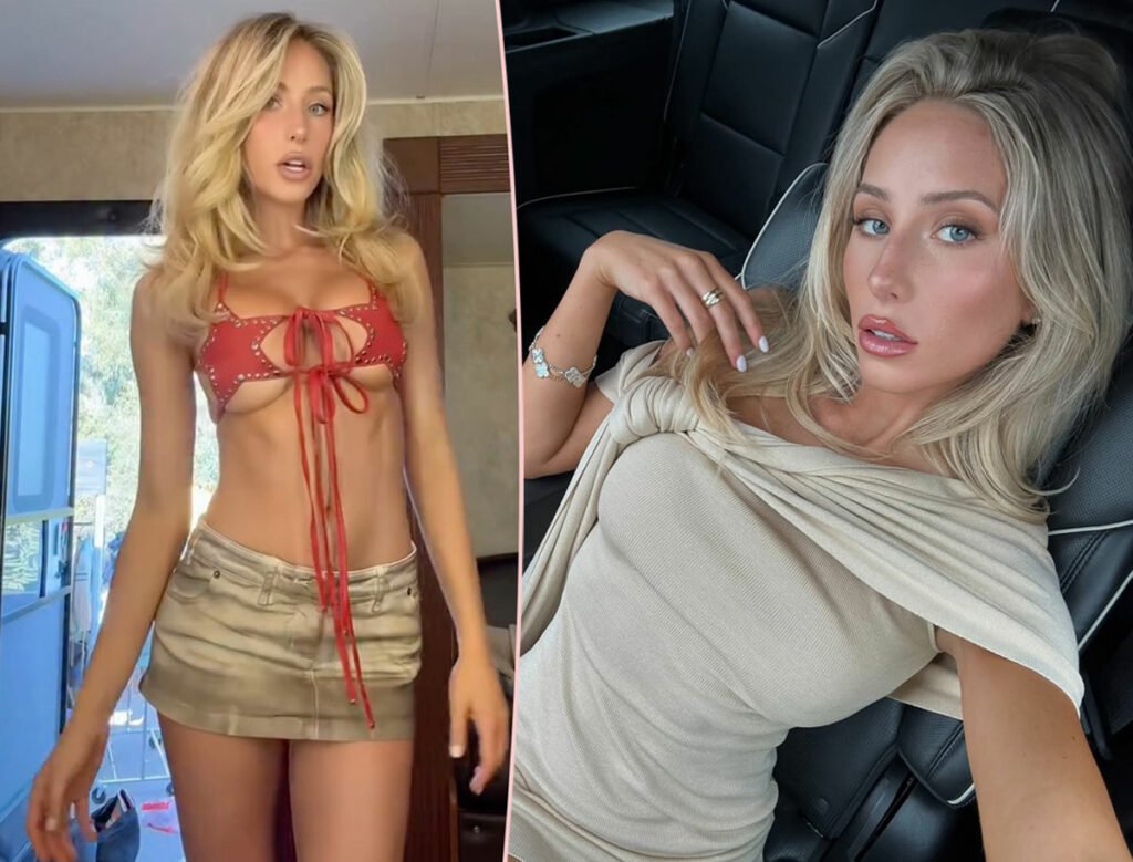 Influencer Alix Earle Reveals The ONE Cosmetic Surgery She Regrets! (You'll Never Guess!)