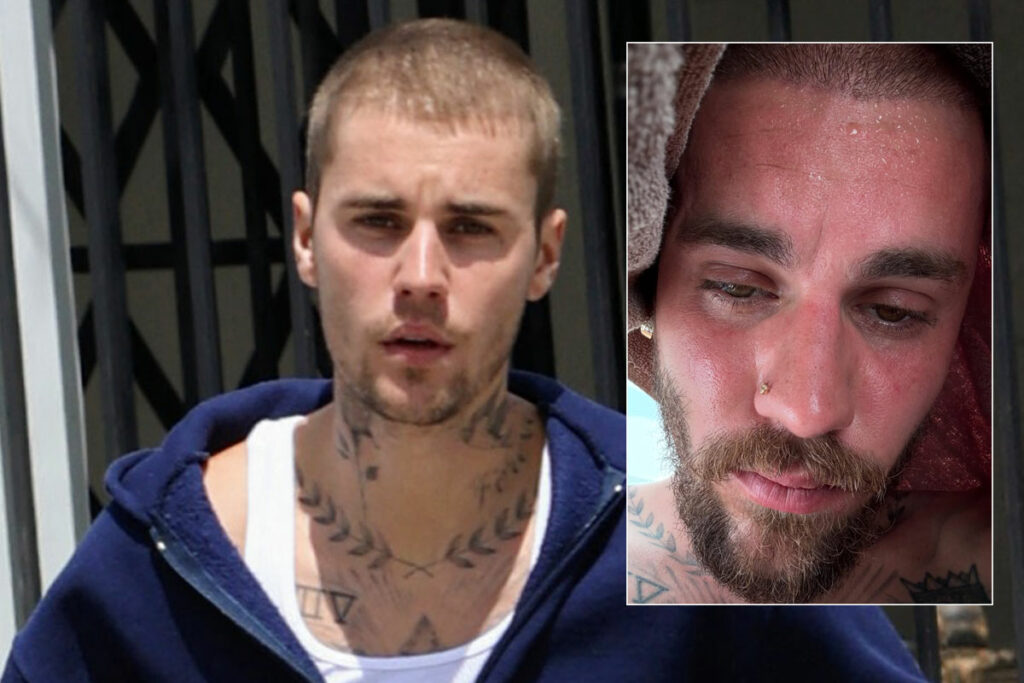 Fans Show Support For Justin Bieber After He Posts About Detoxing