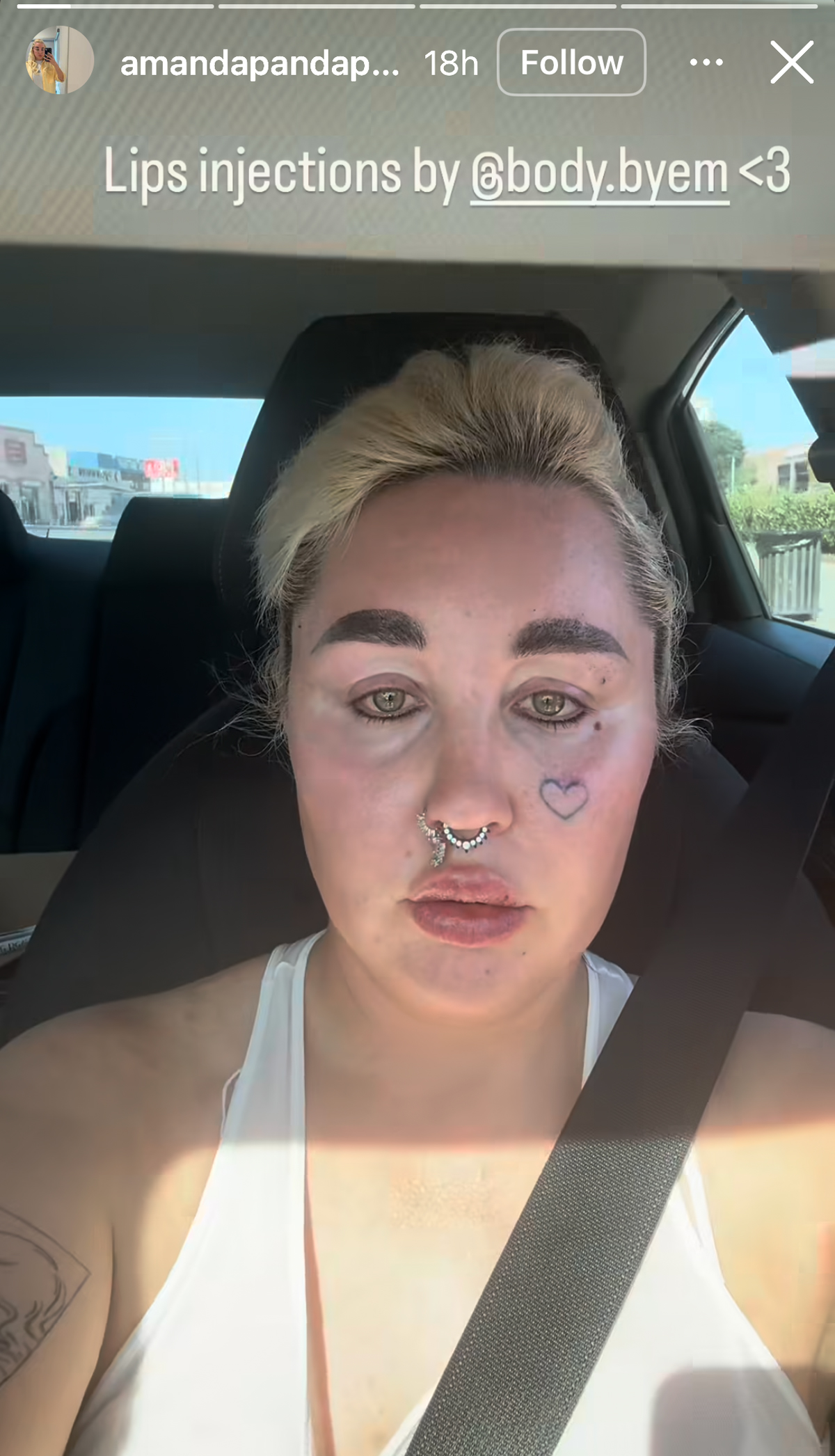 Amanda Bynes Debuts New Look After Undergoing THIS Cosmetic Procedure! 