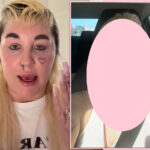 Amanda Bynes Shows Off New Look After Undergoing THIS Cosmetic Procedure!