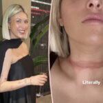 Influencer Almost 'Decapitated' When Her Scarf Got Caught Under Her Car!