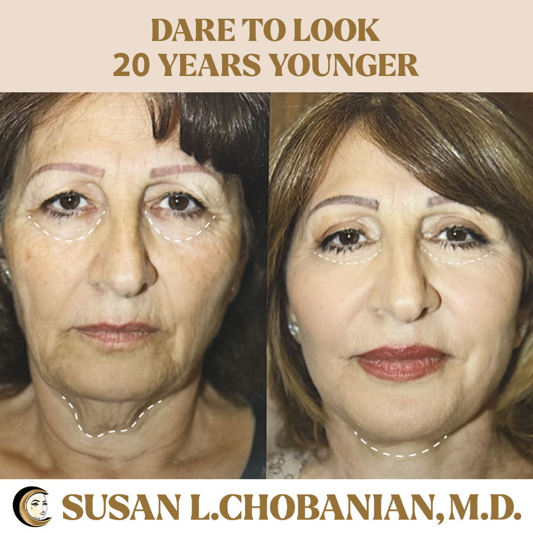 Susan Chobanian work 