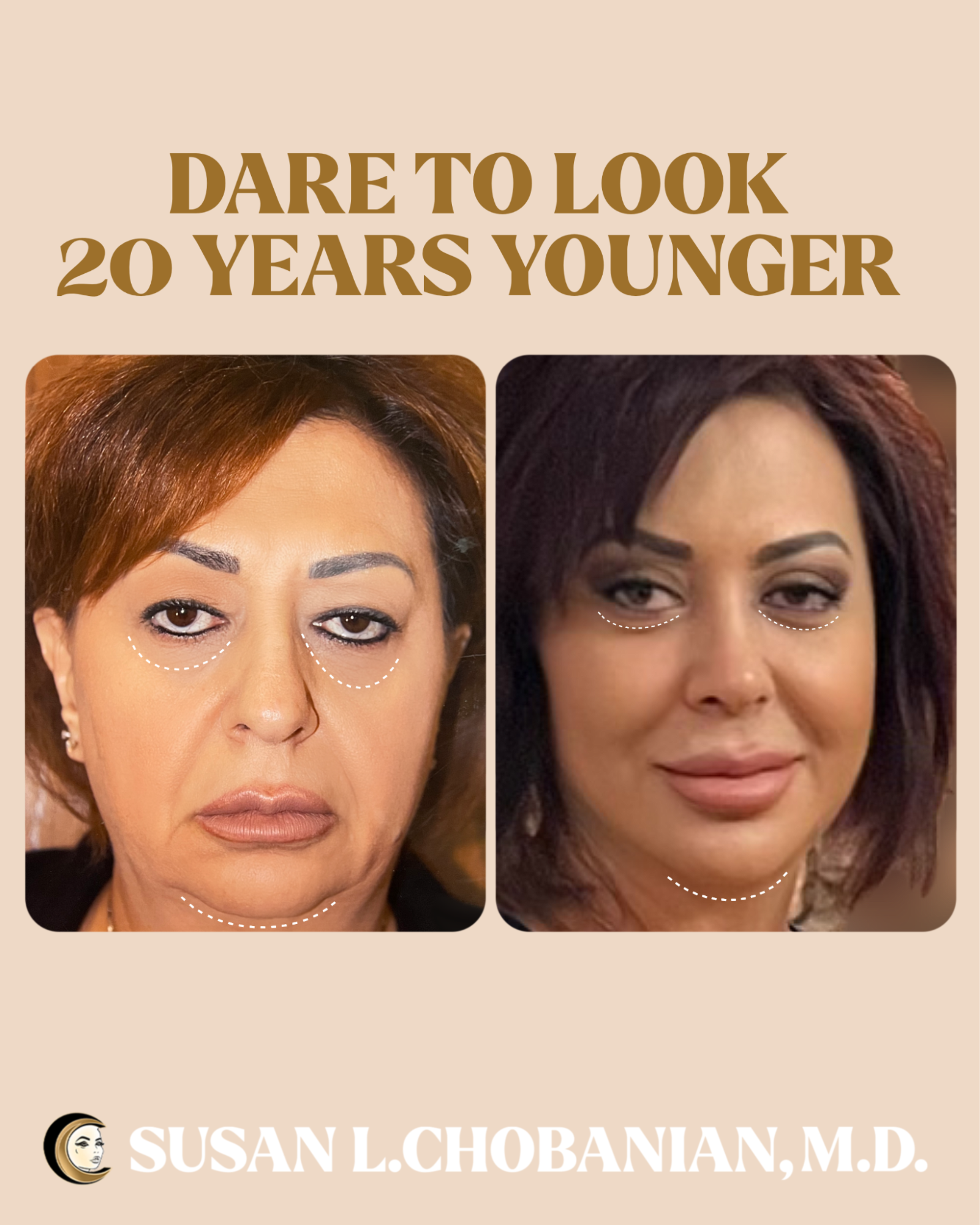 Susan Chobanian's client work