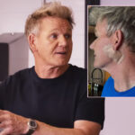 Gordon Ramsay Shows Off Surgery Scar As He Reveals Skin Cancer Diagnosis!