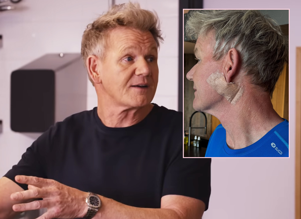 Gordon Ramsay Shows Off Surgery Scar As He Reveals Skin Cancer Diagnosis!