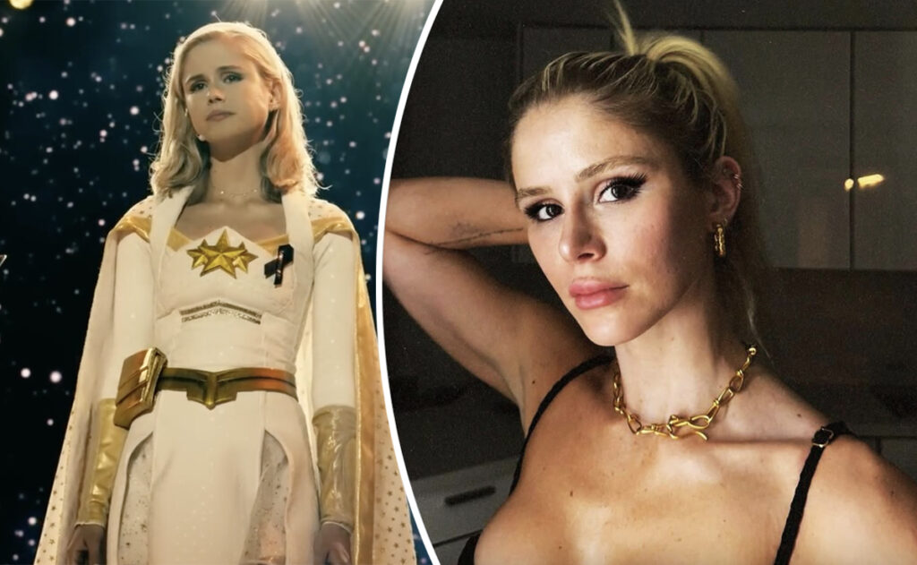 The Boys Erin Moriarty Bikini Selfie Bruises Graves Disease