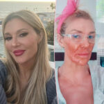 Oh No! Brandi Glanville HORRIFICALLY Burned Her Face! Do NOT Do This!!!