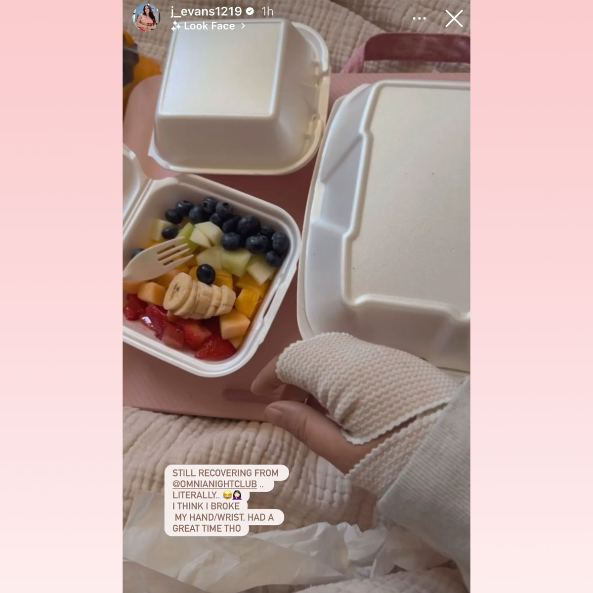 Jenelle Evans says she broke hand/wrist at night club
