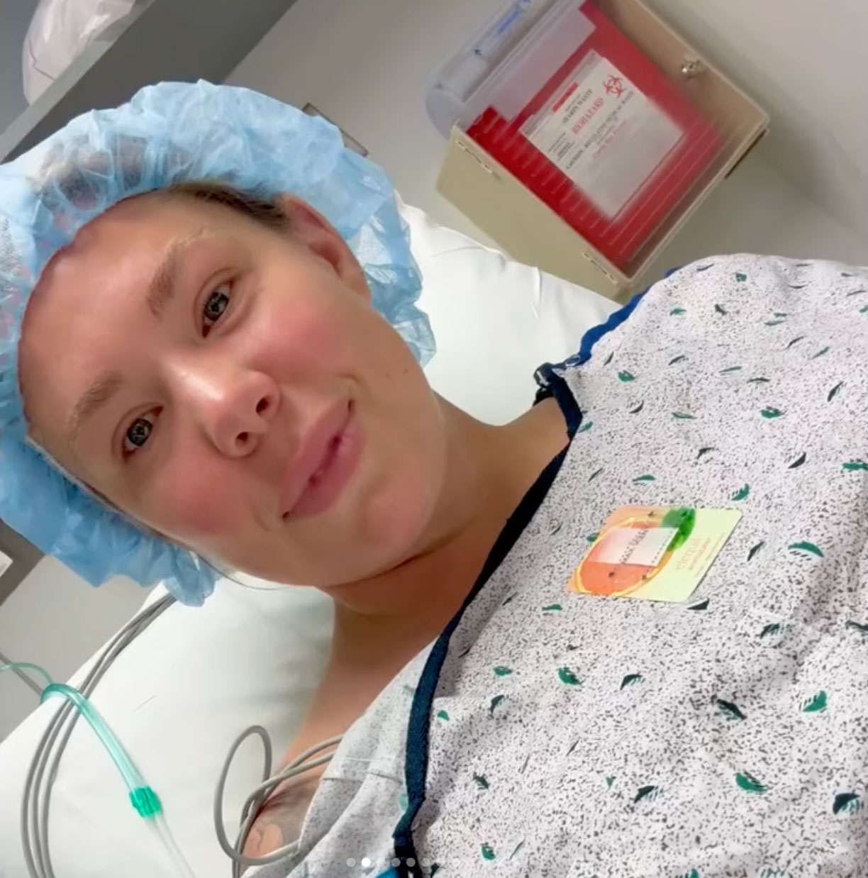 Kailyn Lowry double chin surgery before and after
