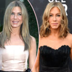 Jennifer Aniston Reveals What Cosmetic Procedures She's Gotten Done!